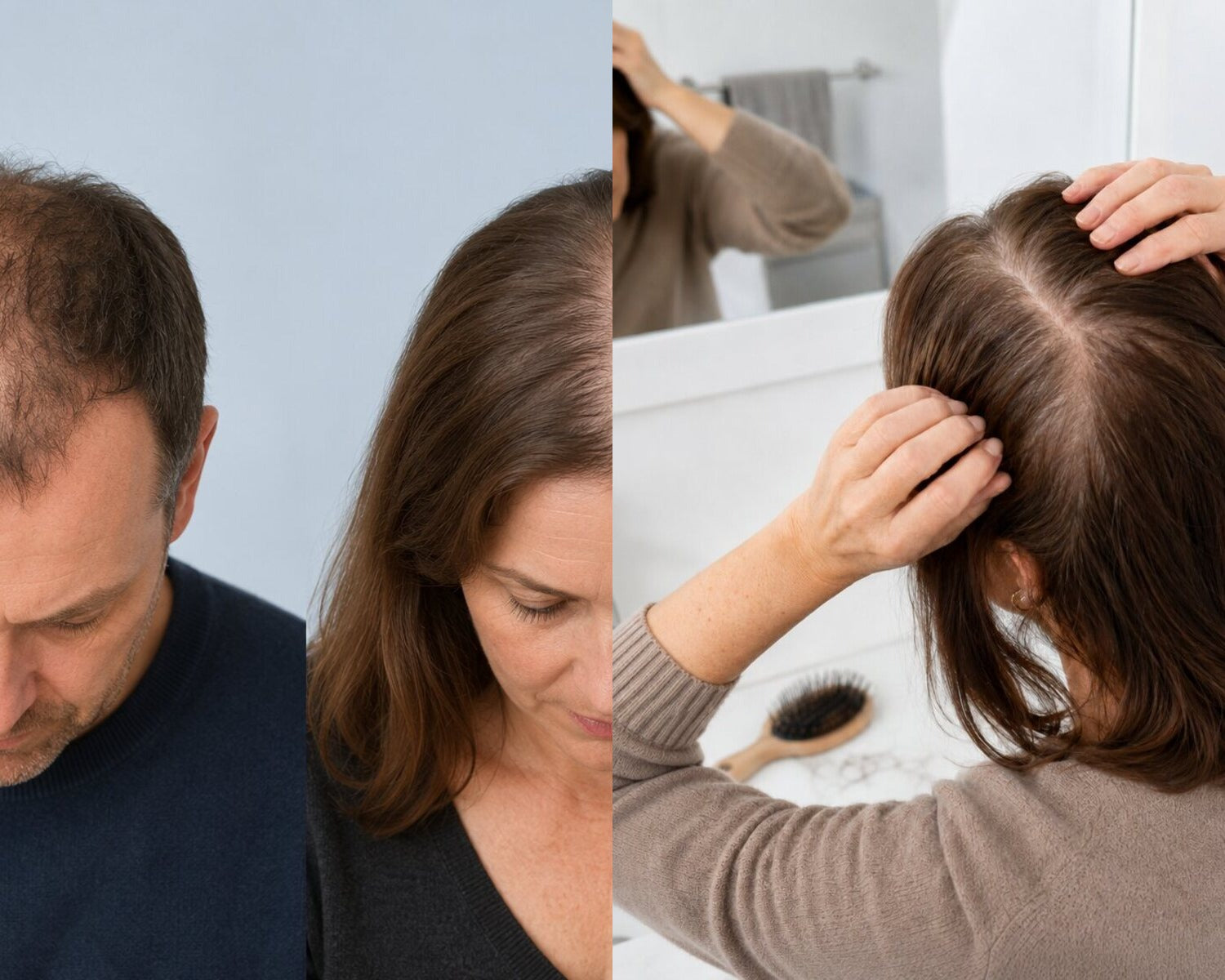 Vergleich zwischen erblich bedingtem und diffusem Haarausfall